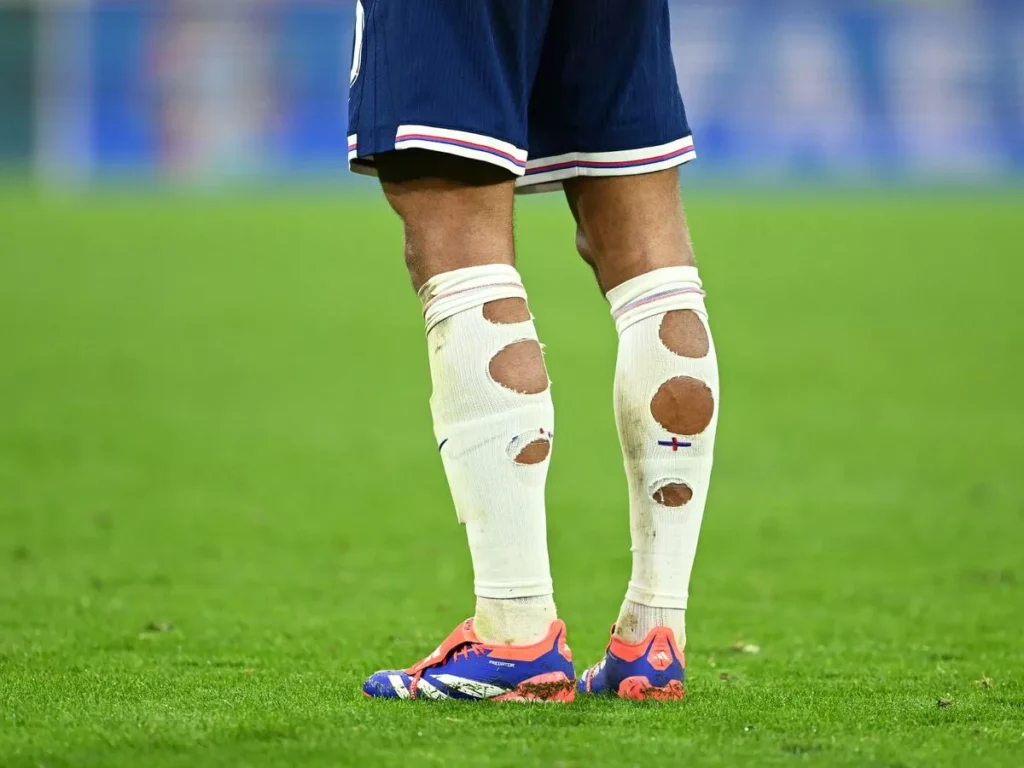 Why have England players got holes in their socks?
